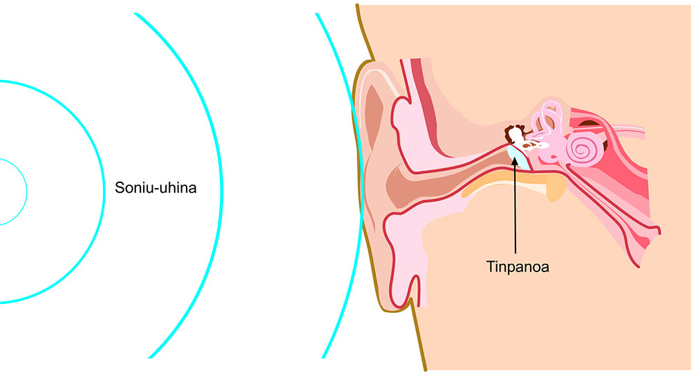 Soinuaren iraupena 2